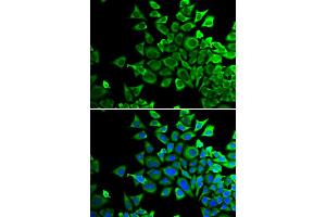 Immunofluorescence analysis of HeLa cells using BAD antibody (ABIN5970771).