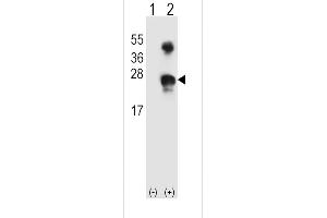 Western blot analysis of GADD45A (arrow) using rabbit polyclonal GADD45A Antibody (N-term) (ABIN389281 and ABIN2839407).