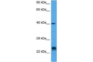 Host:  Mouse  Target Name:  ASCL1  Sample Tissue:  Mouse Pancreas  Antibody Dilution:  1ug/ml (ASCL1 anticorps  (N-Term))