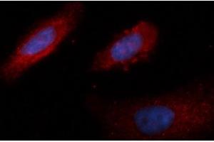 Immunofluorescence (IF) image for anti-Lactate Dehydrogenase B (LDHB) (AA 1-334) antibody (PE) (ABIN5565786) (LDHB anticorps  (AA 1-334) (PE))