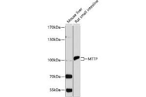Western blot analysis of extracts of various cell lines, using MTTP antibody (ABIN3022483, ABIN3022484, ABIN3022485 and ABIN6218847) at 1:1000 dilution. (MTTP anticorps  (AA 1-130))