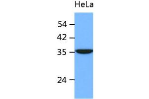The cell lysates of HeLa (40ug) were resolved by SDS-PAGE, transferred to PVDF membrane and probed with anti-human ING2 antibody (1:1000). (ING2 anticorps)