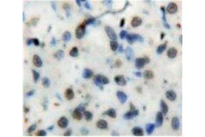 Used in DAB staining on fromalin fixed paraffin-embedded Stomach tissue (NFkB anticorps  (AA 42-367))