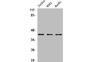 Western Blot analysis of Jurkat K562 HuvEc cells using α-SMA Polyclonal Antibody