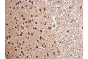 IHC-P Image MEF2C antibody detects MEF2C protein at nucleus on mouse fore brain by immunohistochemical analysis. (MEF2C anticorps)