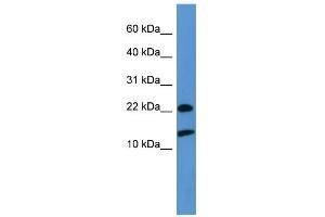 WB Suggested Anti-RPS27A Antibody Titration: 0. (RPS27A anticorps  (Middle Region))
