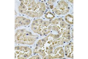 Immunohistochemistry of paraffin-embedded human kidney using GALNT2 Antibody (ABIN5974158) at dilution of 1/100 (40x lens). (GALNT2 anticorps)