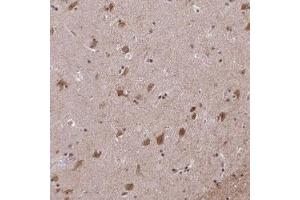 Immunohistochemical staining (Formalin-fixed paraffin-embedded sections) of human lateral ventricle with ARPP-21 polyclonal antibody  shows moderate cytoplasmic and nuclear positivity in neuronal cells. (ARPP21 anticorps)