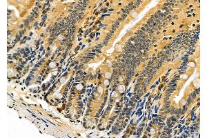 ABIN6260741 and ABIN6276422 at 1/100 staining Mouse colorectal tissue by IHC-P.