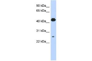 WB Suggested Anti-PDIK1L Antibody Titration: 0. (PDIK1L anticorps  (Middle Region))