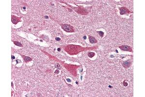 Anti-LRRC7 antibody IHC of human brain, cortex. (LRRC7 anticorps  (N-Term))