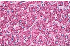 Image no. 3 for anti-Superoxide Dismutase 2, Mitochondrial (SOD2) antibody (ABIN1496289) (SOD2 anticorps)