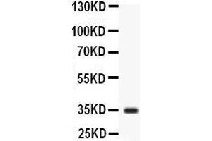 Observed bind size: 35KD (Liver Arginase anticorps  (N-Term))