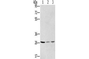 Western Blotting (WB) image for anti-Hydroxysteroid (17-Beta) Dehydrogenase 12 (HSD17B12) antibody (ABIN2423602) (HSD17B12 anticorps)