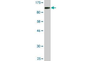 Western Blot detection against Immunogen (85. (CHEK2 anticorps  (AA 1-543))