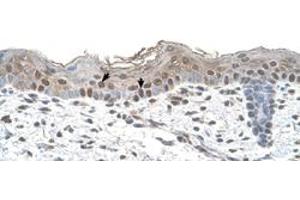 Immunohistochemical staining (Formalin-fixed paraffin-embedded sections) of human skin with ARRB2 polyclonal antibody  at 4-8 ug/mL working concentration.