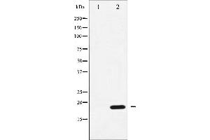 Western blot analysis of CPI17 alpha phosphorylation expression in RAW264.