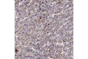 Immunohistochemical staining of human liver with APOH polyclonal antibody  shows moderate cytoplasmic positivity, with a granular pattern, in hepatocytes. (APOH anticorps)
