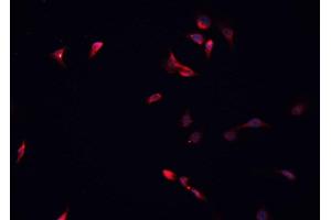 ABIN6266881 staining HeLa cells by IF/ICC.