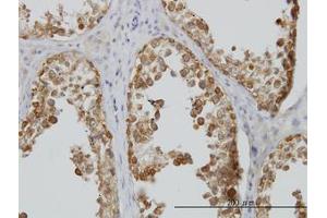 Image no. 4 for anti-DEAD (Asp-Glu-Ala-Asp) Box Polypeptide 6 (DDX6) (AA 1-484) antibody (ABIN598641) (DDX6 anticorps  (AA 1-484))