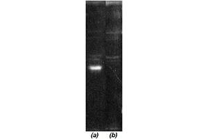 Western blot analysis: Luminograph of a HeLa S3 cytosol preparation after SDS PAGE followed by blotting onto PVDF membrane and probing with (a) antibody  and (b) antibody  pre-absorbed with cognate peptide. (COP9 Signalosome Csn6 Subunit (AA 283-297) anticorps)