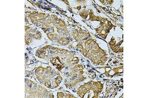 Immunohistochemistry of paraffin-embedded human stomach using CDH6 antibody. (CDH6 anticorps  (AA 1-250))