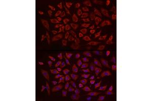 Immunofluorescence analysis of A-549 using EIF4B antibody (ABIN6127837, ABIN6140078, ABIN6140080 and ABIN6217245) at dilution of 1:25 (40x lens). (EIF4B anticorps  (AA 352-611))