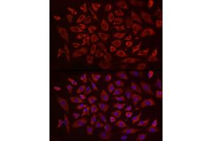 Immunofluorescence analysis of A-549 using EIF4B antibody (ABIN6127837, ABIN6140078, ABIN6140080 and ABIN6217245) at dilution of 1:25 (40x lens). (EIF4B anticorps  (AA 352-611))