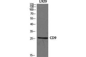 Western Blot (WB) analysis of specific cells using CD9 Polyclonal Antibody. (CD9 anticorps  (Internal Region))