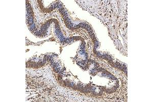 IHC analysis of Syntenin 2/SDCBP2 using anti-Syntenin 2/SDCBP2 antibody (ABIN7600017).
