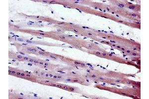 Immunohistochemistry of paraffin-embedded human heart tissue using ABIN7160421 at dilution of 1:100 (MPZL1 anticorps  (AA 195-258))