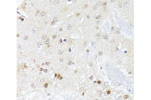 Immunohistochemistry of paraffin-embedded Mouse brain using EGLN1/EGLN2 Polyclonal Antibody at dilution of 1:100 (40x lens). (EGLN1 anticorps)