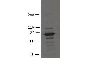 Image no. 1 for anti-Plakophilin 3 (PKP3) (AA 1-308) antibody (ABIN1169701) (Plakophilin 3 anticorps  (AA 1-308))