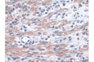 IHC-P analysis of Mouse Uterus Tissue, with DAB staining. (ITGA3 anticorps  (AA 33-236))