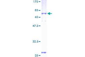 Image no. 1 for Glycerol Phosphate Dehydrogenase 2, Mitochondrial (GPD2) (AA 1-378) protein (GST tag) (ABIN1355536)