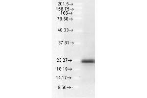 Western blot analysis of Human A549 cell lysates showing detection of BIM protein using Rabbit Anti-BIM Polyclonal Antibody . (BIM anticorps  (APC))