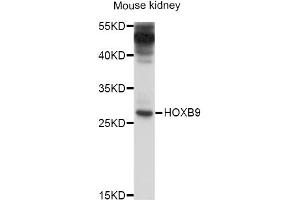 Western blot analysis of extracts of mouse kidney, using HOXB9 antibody (ABIN4903958) at 1:1000 dilution. (HOXB9 anticorps)
