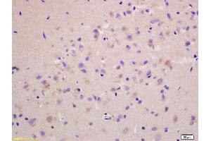Formalin-fixed and paraffin embedded rat brain labeled with Anti-G protein alpha S Polyclonal Antibody, Unconjugated (ABIN751438) at 1:200 followed by conjugation to the secondary antibody and DAB staining. (G Protein alpha S (AA 901-1037) anticorps)