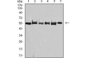 Western blot analysis using TRAF2 mouse mAb against MCF-7 (1), A431 (2), Hela (3), Jurkat (4), HEK293 (5), and Ramos (6) cell lysate.
