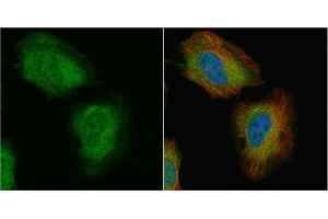 ICC/IF Image Transgelin antibody detects Transgelin protein at cytoplasm and nucleus by immunofluorescent analysis. (Transgelin anticorps)