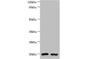 Western blot All lanes: Peptidyl-tRNA hydrolase 2, mitochondrial antibody at 4 μg/mL Lane 1: MM231 whole cell lysate Lane 2: Jurkat whole cell lysate Secondary Goat polyclonal to rabbit IgG at 1/10000 dilution Predicted band size: 19 kDa Observed band size: 19 kDa (PTRH2 anticorps  (AA 40-179))
