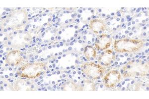 Detection of IFNg in Rabbit Kidney Tissue using Polyclonal Antibody to Interferon Gamma (IFNg) (Interferon gamma anticorps  (AA 24-167))