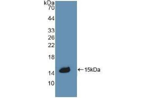 Detection of Recombinant CBG, Rat using Polyclonal Antibody to Corticosteroid Binding Globulin (CBG) (SERPINA6 anticorps  (AA 267-390))