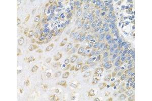 Immunohistochemistry of paraffin-embedded Human esophagus using Polyclonal AntibodyPC4 Polyclonal Antibody at dilution of 1:100 (40x lens).