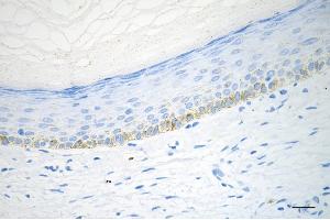 Immunohistochemistry was performed on paraffin-embedded human skin tissue using SPINK5 antibody (ABIN7800302), 1:200).