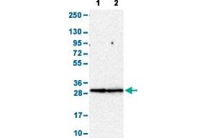 Western Blot analysis with FCGR3A polyclonal antibody . (FCGR3A anticorps  (AA 227-254))