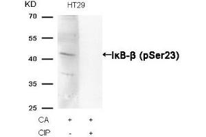 Western blot analysis of extracts from HT29 cells, treated with CA or calf intestinal phosphatase (CIP), using IκB-β (Phospho-Ser23) Antibody.