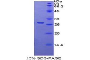 SDS-PAGE analysis of Mouse RARa Protein.