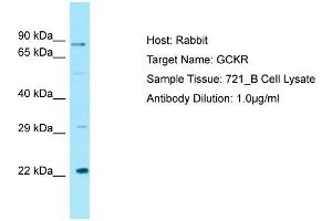 Host: RabbitTarget Name: GCKRAntibody Dilution: 1. (GCKR anticorps  (C-Term))