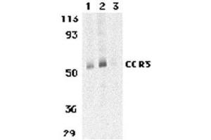 Western blot analysis of CCR3 in human spleen tissue lysates with AP30215PU-N CCR3 antibody at 1 (lane 1) and 2 μg/ml (lane 2), and 2 μg/ml in the presence of blocking peptide (lane 3).